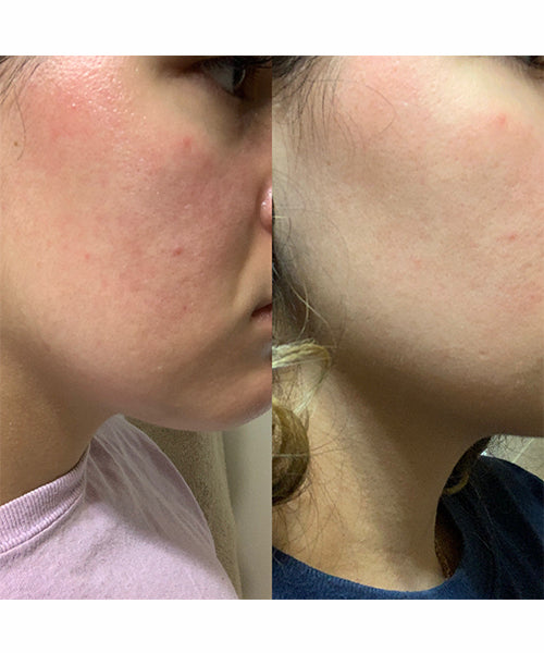 Huile de soin multi-usage visage, cheveux et cuir chevelu – vue 4